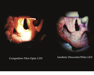 Lateral Medical Anaesthetics Critical Care - Airway Management IntuBrite Dual LED Disposable Laryngoscope Airway Illumination Actual Comparison Scan