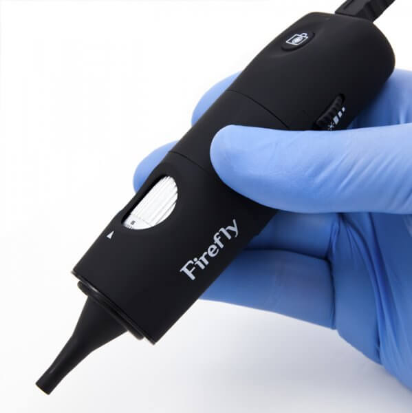 ento digital otoscope